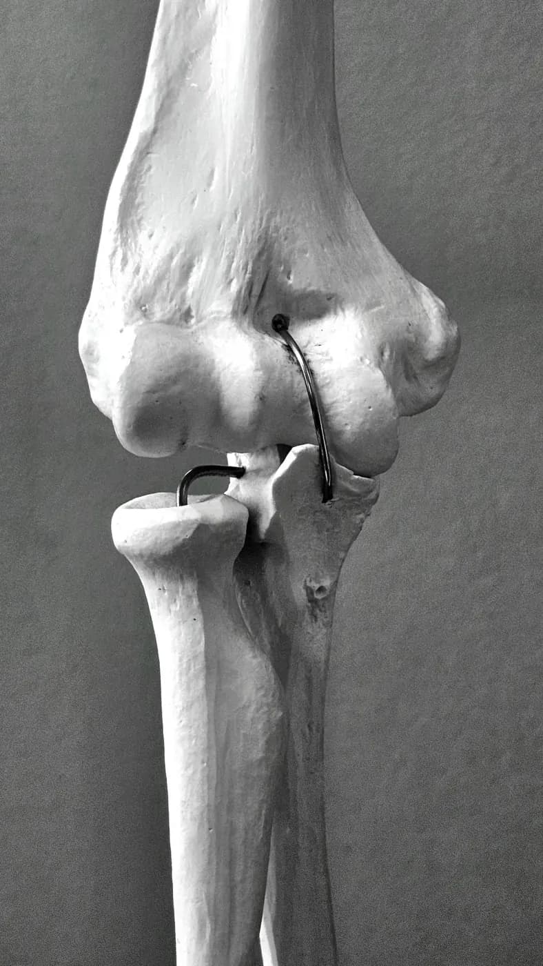 Joint Health and Mobility: Managing Knee Pain and Arthritis
