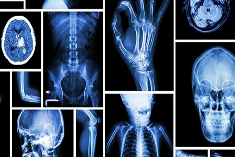 Radiology in Bhiwadi